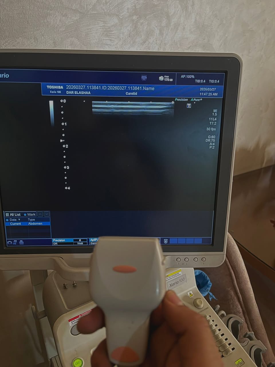 متوفر بروبات Toshiba Xario 100 / 200 بحالة ممتازة (كأنها جديدة) — صورة 2 من 5