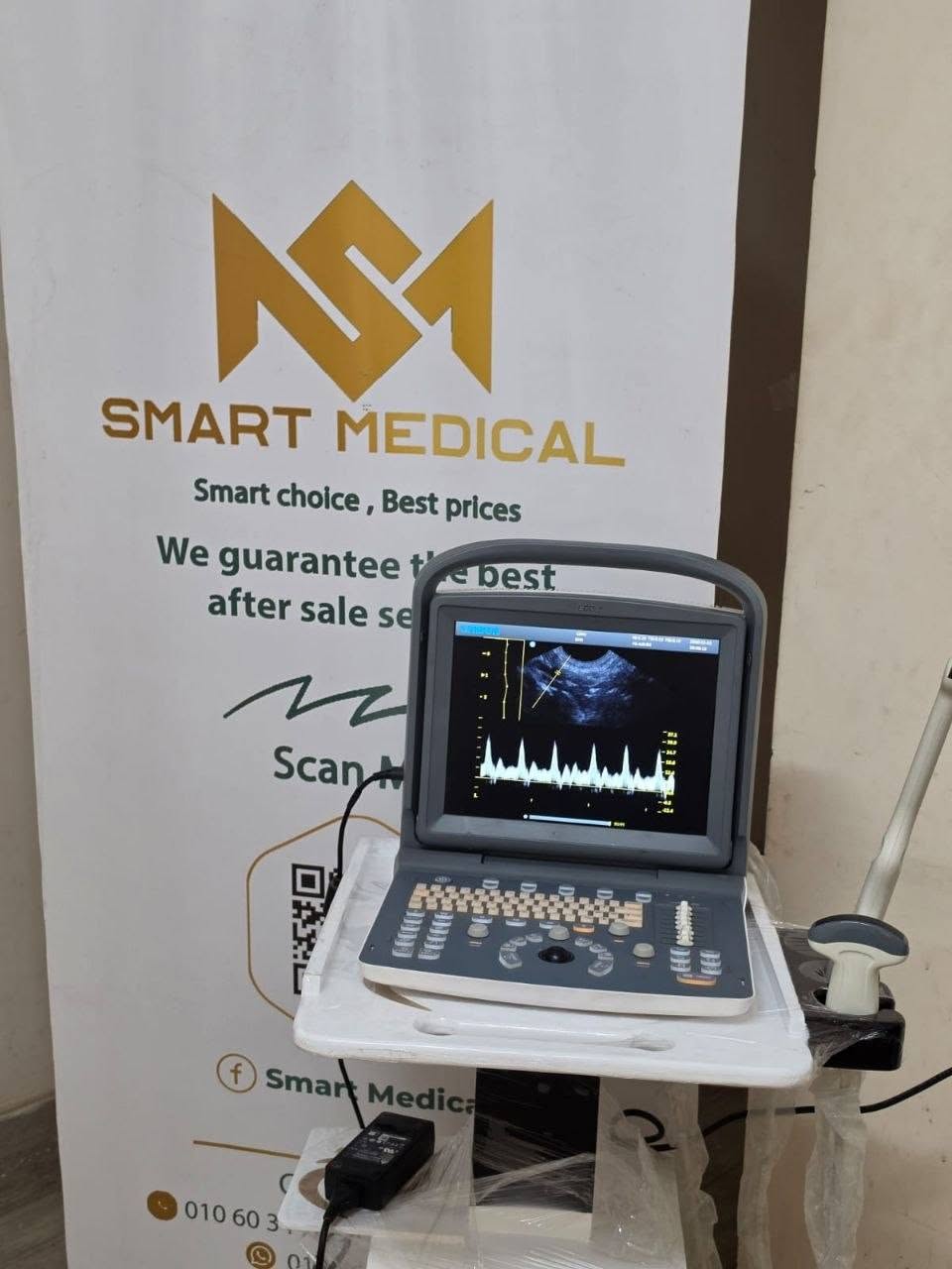 Chison Echo 2 إنتاج 2018 كونفكــس وفجينال — صورة 2 من 4