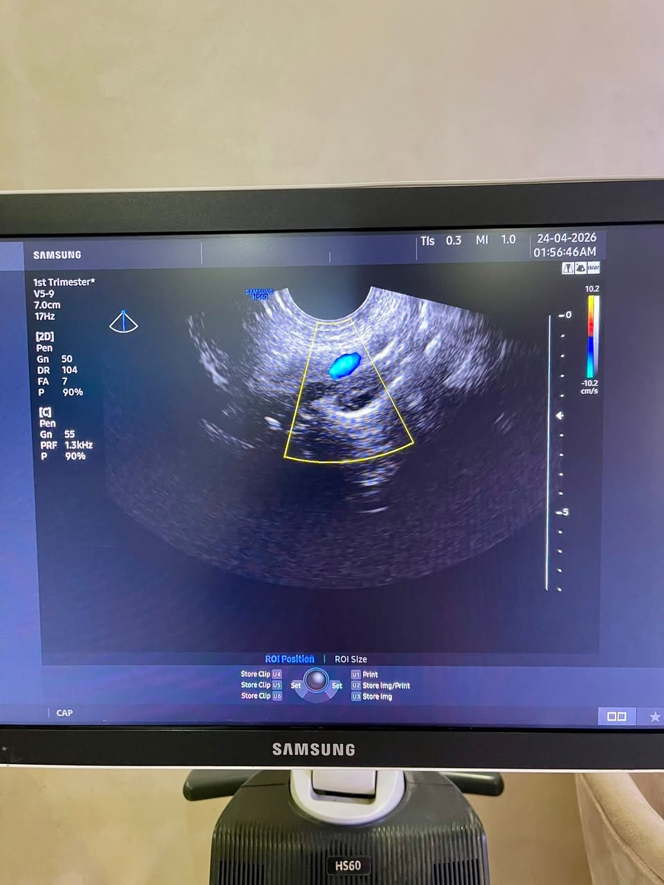 للبيع Samsung V5-9 4D Vaginal Probe — صورة 3 من 5