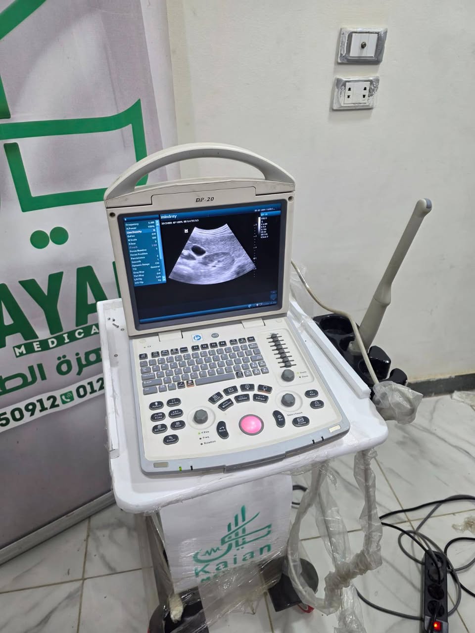 DP20 من مندراي جهاز على قدّ الشغل ويفي بالغرض — صورة 2 من 3