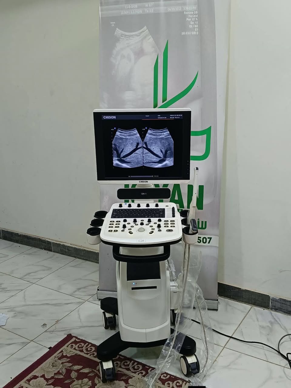 Chison QBit 5 حالة زيرو 2 Probe — صورة 2 من 3