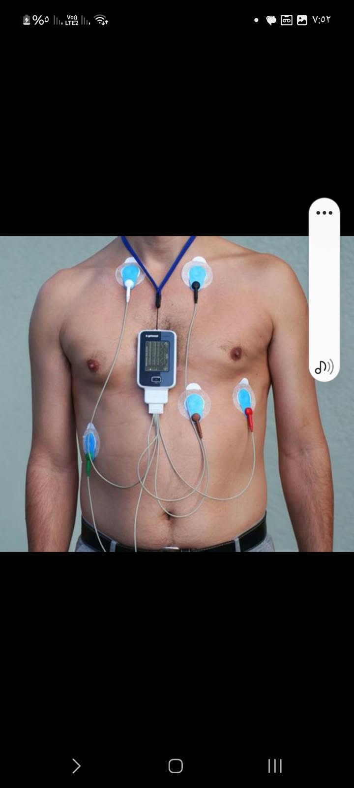Holter monitor — صورة 1 من 1