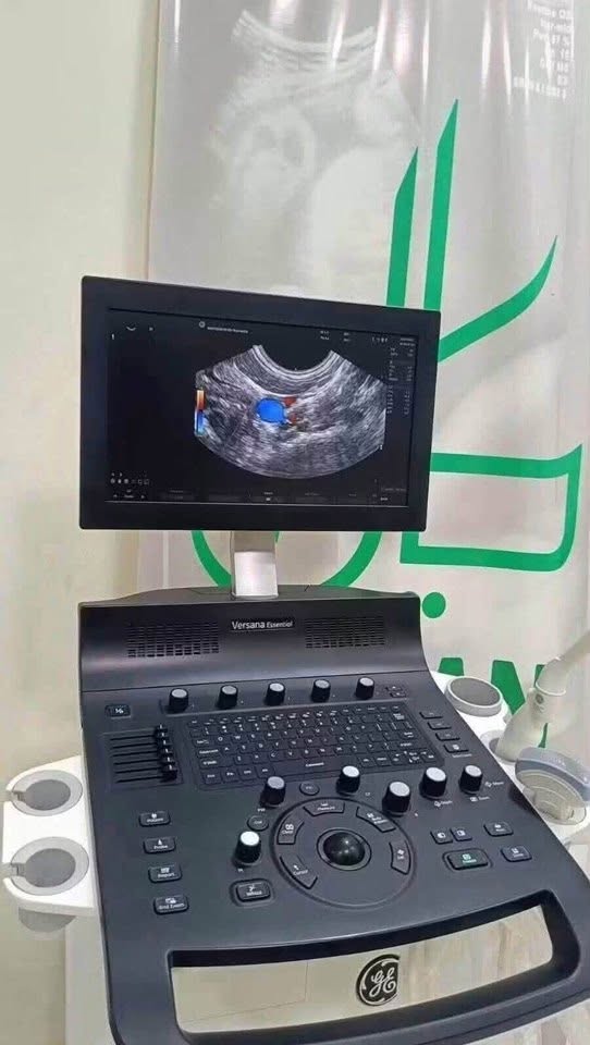 ارتقِ بدقة تشخيصك مع عائلة GE Versana Essential.. الآن في عيادتك — صورة 2 من 2