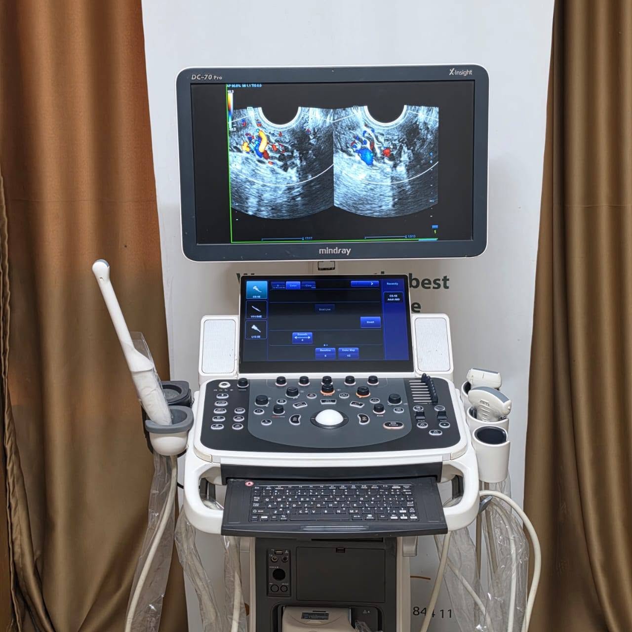 Mindray Dc70 pro xinsight — صورة 2 من 5
