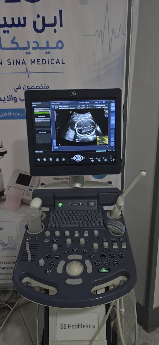 لعشاق البراند voluson p8 3probe — صورة 2 من 2