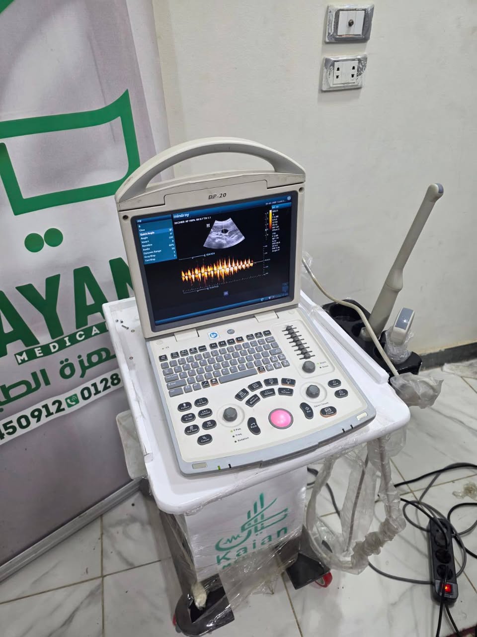DP20 من مندراي جهاز على قدّ الشغل ويفي بالغرض — صورة 3 من 3