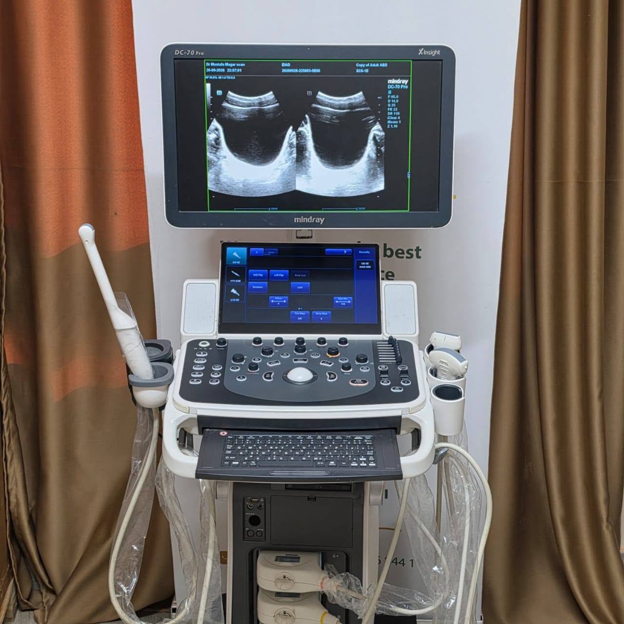 Mindray Dc70 pro xinsight — صورة 5 من 5