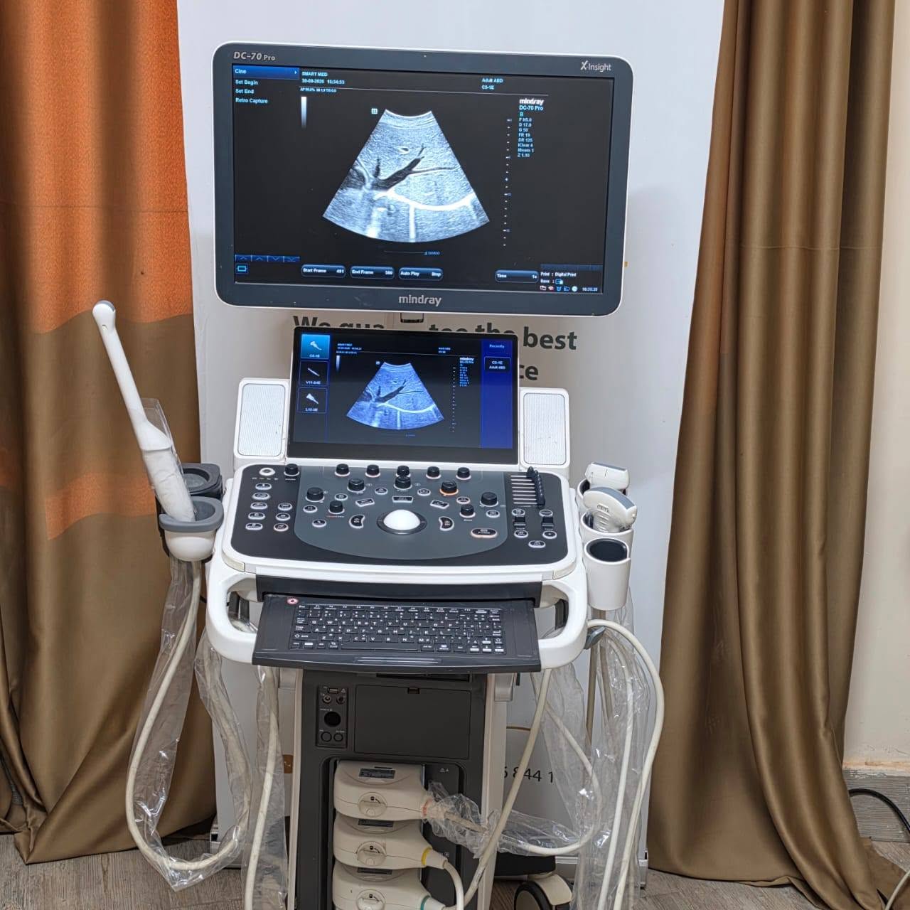 Mindray Dc70 pro xinsight — صورة 4 من 5