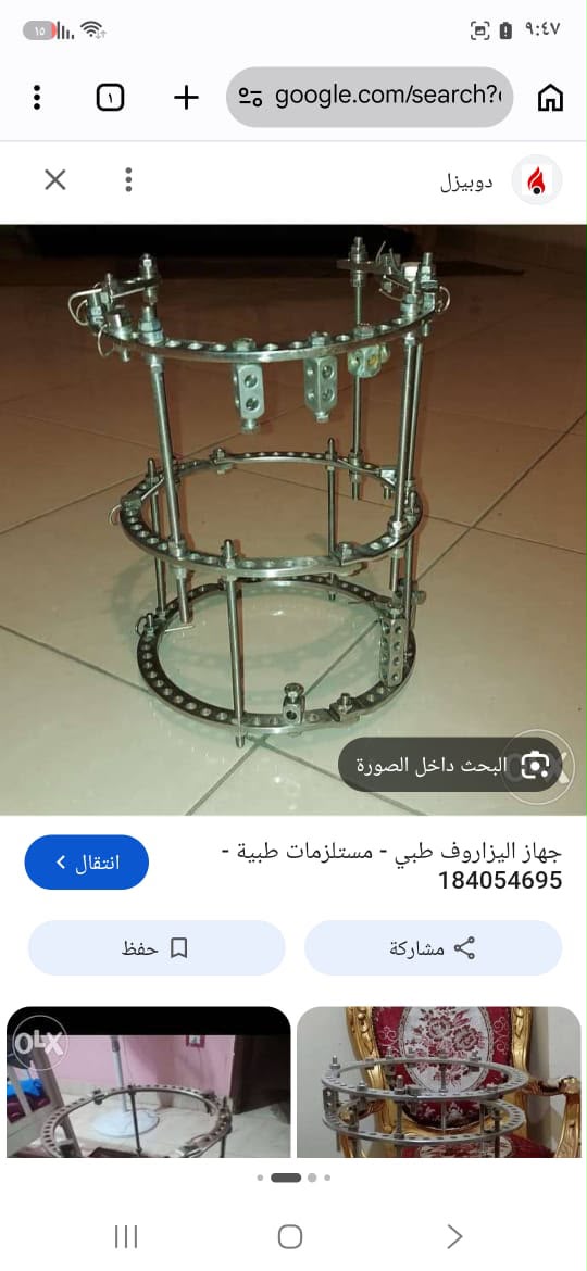 الجهاز دا موجود Ilizarov — صورة 1 من 1