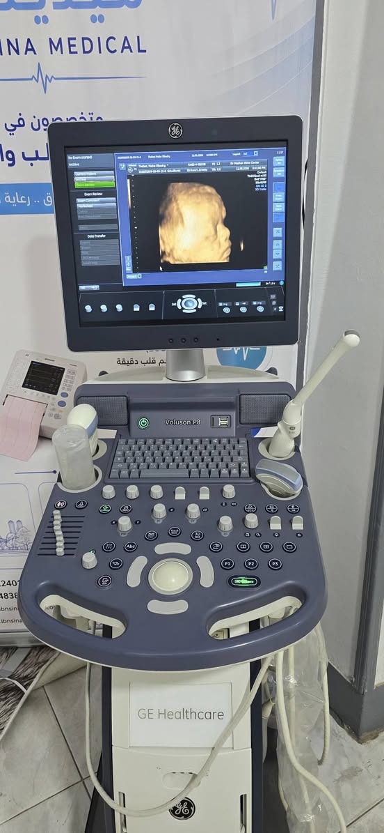 لعشاق البراند voluson p8 3probe — صورة 1 من 2