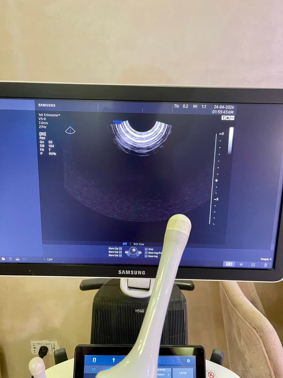 للبيع Samsung V5-9 4D Vaginal Probe — صورة 1 من 5